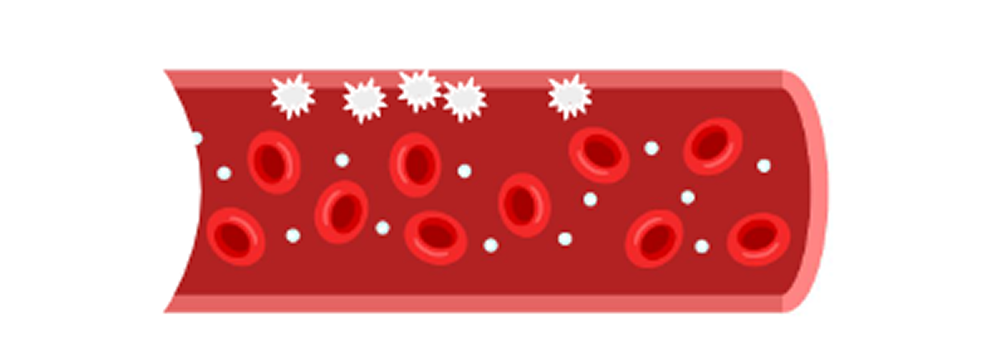 血圧が高い状態が続くと、血管の内側が傷つきます。
